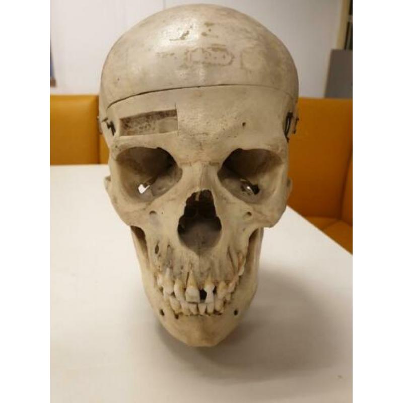 Mensen schedel Antiek medisch compleet