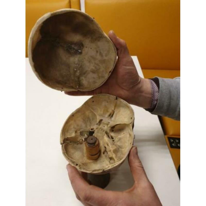 Mensen schedel Antiek medisch compleet
