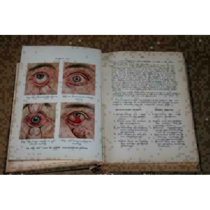 Leerboek der Oogziekten - 1916 !!