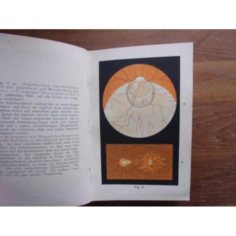 Oogheelkunde. O. Haab: Atlas der Ophtalmoskopie.(1895)