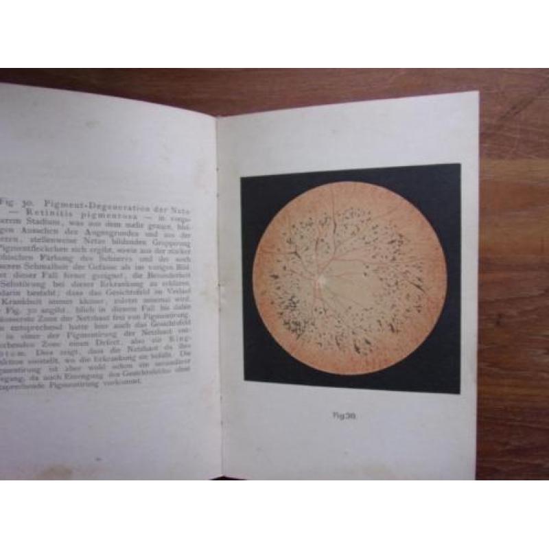 Oogheelkunde. O. Haab: Atlas der Ophtalmoskopie.(1895)